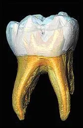 Les molaires servent  dcouper la nourriture.