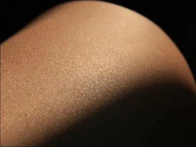 La fonction principale de la peau est de protger des agressions bactriennes.