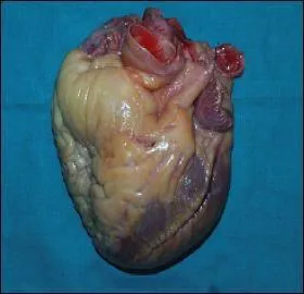 Le coeur est  peu prs gros comme le poing.