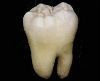 Tous les adultes ont des dents de sagesse.