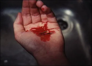 Une plaie arrte de saigner car le sang coagule  l'air.