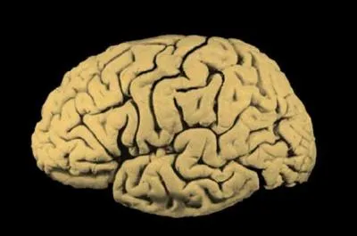 On peut vivre sans cerveau.