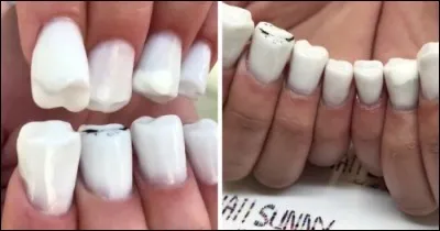 Il existe depuis quelques temps, venant d'outre-Atlantique, le "nail-art" (ou art des ongles). Le mot Art est quelque peu galvaudé quand on voit ici le résultat abominable obtenu. Quelle type de dent est ici utilisé ?