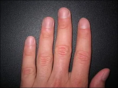 Si nous passions la vie sans nous couper les ongles, quelle longueur atteindraient ceux-ci ?