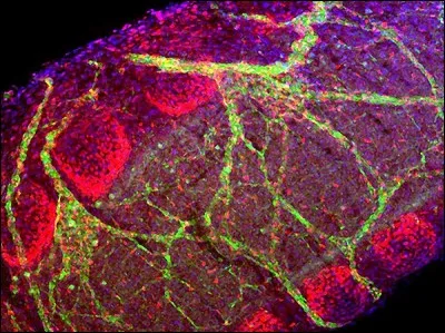 Le croyez-vous, ce magnifique maillage de couleurs représente le tube qui amène l'air dans les poumons, autrement dit [...].
