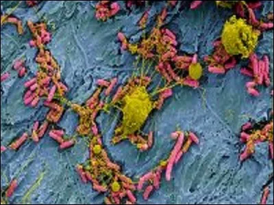 Que voit votre microscope à balayage électronique ? Ben, l'intérieur d'une vessie de souris souffrant d'une infection urinaire !
Que sont les éléments en jaune ?