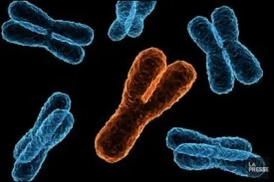 Lorsque quelqu'un possède 3 chromosomes à la paire 21, il a malheureusement : ...