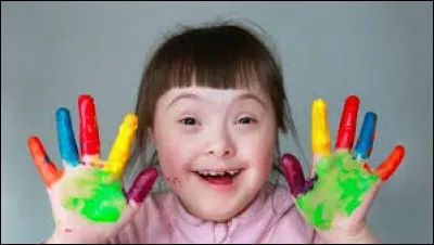 Les trisomiques ont la t&ecirc;te petite et ronde.