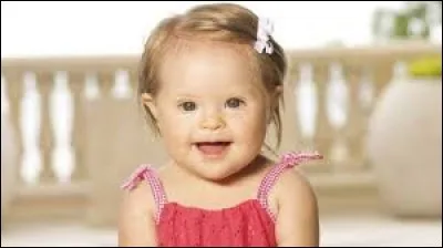 Il y a plus de 2300 cas de trisomie 21 en France tous les ans.