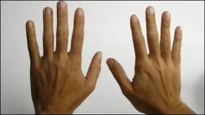 Quelle est la particularité d'une personne autant adroite de la main gauche que de la droite ?