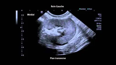 La gestation d'un cheval dure...