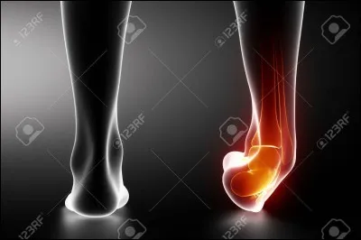 Vous pouvez monter la vôtre si vous êtes ambitieux et il est bien certain qu'on finira dedans. Pour ne pas y être, saurez-vous quoi répondre ?