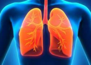 Quiz Embolie pulmonaire