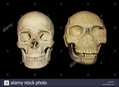 En 1912 Charles Dawson découvre l'homme de Piltdown dans le sud de l'Angleterre. Ce crâne était censé être le fameux chaînon manquant entre le singe et l'homme ; de quoi était-il fait ? (Photo non contractuelle)