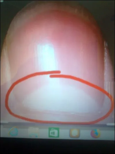 Comment s'appelle la partie blanche sur les ongles ?