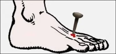 « Les pauvres votent pour que les riches leur enfoncent des clous dans les pieds »
De qui est cette phrase ?