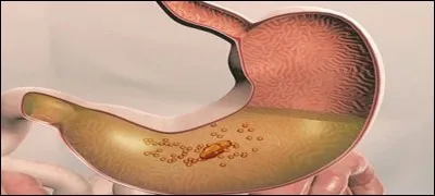 Voil&agrave; votre entrec&ocirc;te-frites bien r&eacute;duite ! Mais ce n'est pas fini, que se passe-t-il dans l'estomac o&ugrave; elle vient de descendre bien tranquillement, car vous avez m&acirc;ch&eacute; lentement ?