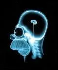 Qu'a  Homer dans son cerveau qui le rend idiot ?