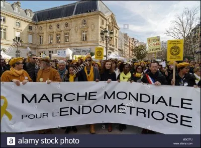 Qui ne peut pas être atteint d'endométriose ?