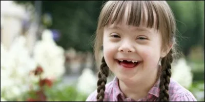 /Sciences de la Vie et de la Terre/ De quelle maladie génétique les caractères physiques de cet enfant sont-ils caractéristiques ?