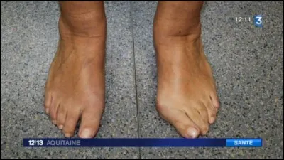 Quel est son pied fort ?