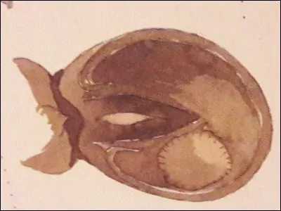 Quelle est cette blessure ?