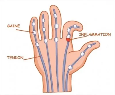 Que représente cette image ?