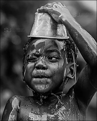Quel pigment donne la peau noire à cet enfant ?