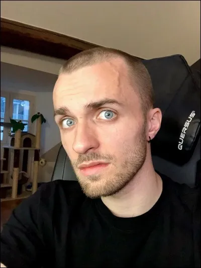 De quelle couleur sont les cheveux de Squeezie ?