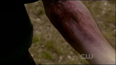 Comment gu&eacute;rir les blessures inflig&eacute;s par les loups-garous aux vampires ?