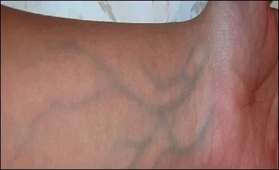 Qu'est une personne qui a le ''sang bleu'' ?