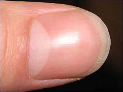 Si je vous dis « tache claire et circulaire située sur la base de chaque ongle », vous répondez :