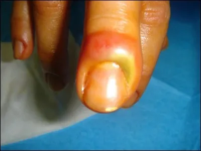 Si je vous dis « Rouge aux ongles », vous répondez :