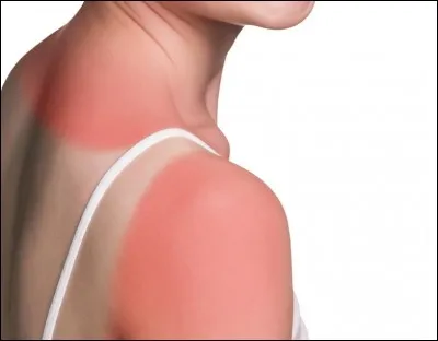 Qui interprétait la chanson ''Le Coup de soleil" ?