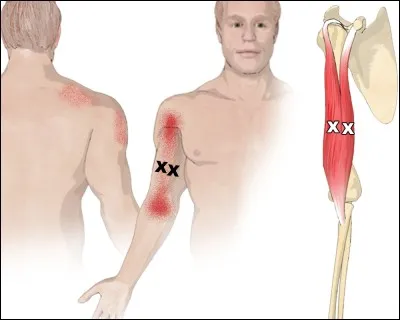 Quel est ce muscle ?