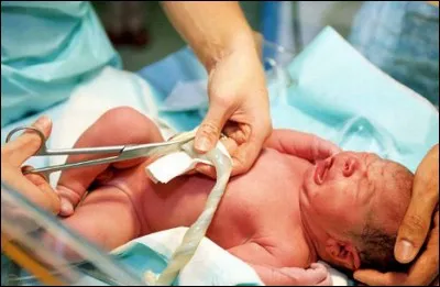 El&eacute;ment d'un cordon !