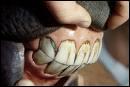 Combien de dents a une jument adulte ?