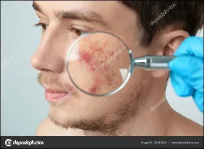 Un dermatologue soigne les problèmes de peau.