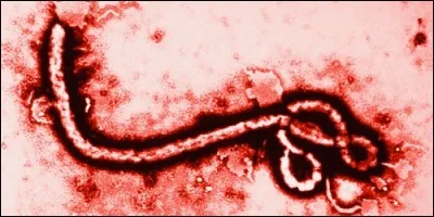 Laquelle de ces maladies terrifiantes ne sévissait pas au Moyen-Age ?