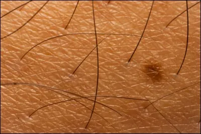 Quel est le nom de la petite structure, similaire &agrave; un sac, du corps humain dans laquelle poussent les poils sur la peau ?