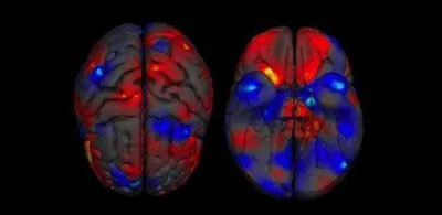 Le cerveau des femmes reste "jeune" plus longtemps que celui des hommes. Vrai ou faux ?