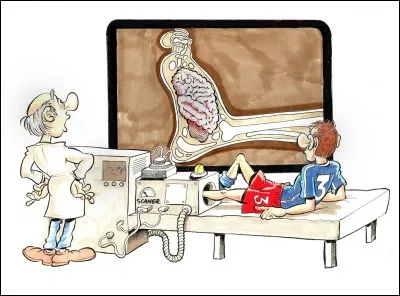 En 1984, lors des éliminatoires de la Coupe des Vainqueurs de Coupe, le grand Barça est battu par une équipe française, la seule à ce jour à avoir réussi cet exploit !