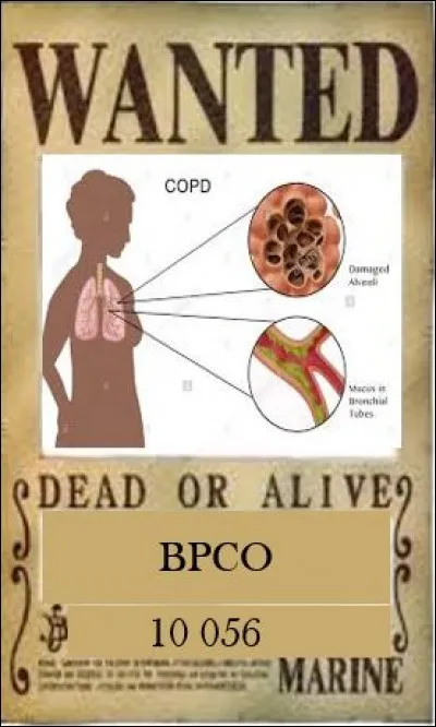 La bronchopneumopathie chronique obstructive (BPCO) cause près de 10 500 décès principalement lors d'aggravations aiguës de la maladie.
Quel est le principal facteur de risque de contracter la maladie ?