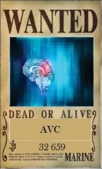 Les accidents vasculaires cérébraux causent près de 32 700 décès par an.
Il existe 3 mécanismes pathologiques à même d'expliquer les accidents vasculaires cérébraux. 
Laquelle de ces propositions n'explique pas les accidents vasculaires cérébraux ?