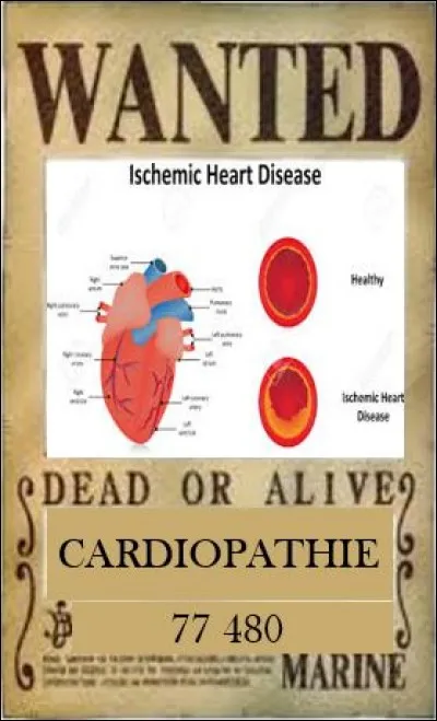 Les cardiopathies sont la deuxième cause de décès avec 77 500 décès. 
La principale cause de cardiopathie est la cardiopathie ischémique par atteinte coronaire avec sa manifestation aigüe qui est l'infarctus du myocarde.
Quel examen est réalisé en premier lieu pour diagnostiquer un infarctus du myocarde ?