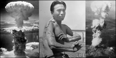 Après la 2e Guerre mondiale, on a nommé certaines personnes « Niju hibakusha ». Ces personnes et certains de leurs descendants ont été discriminés après cette guerre.
Qui sont ces personnes ?