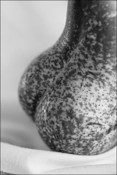 Qui est l'aède grec décrivant la poire comme le fruit des dieux ?