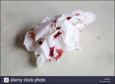 Quel est le réflexe le plus efficace quand on saigne du nez ?