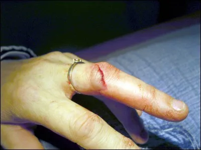 Quel est le meilleur produit à appliquer pour désinfecter une plaie ?