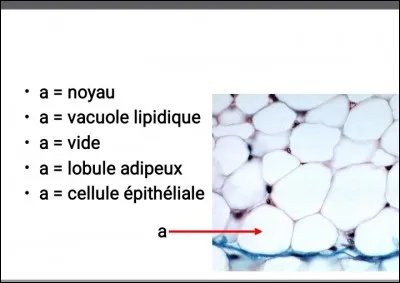 A quoi correspond l'élément "a"